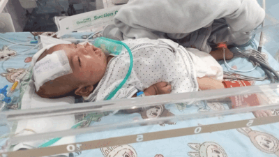 Bayi yang derita penyakit jantung yang dirawat di RSUP M. Djamil Padang.